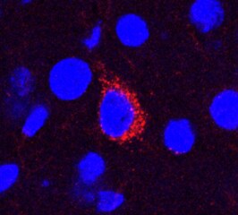 beta Amyloid Antibody (MOAB-2) - BSA Free NBP2-13075