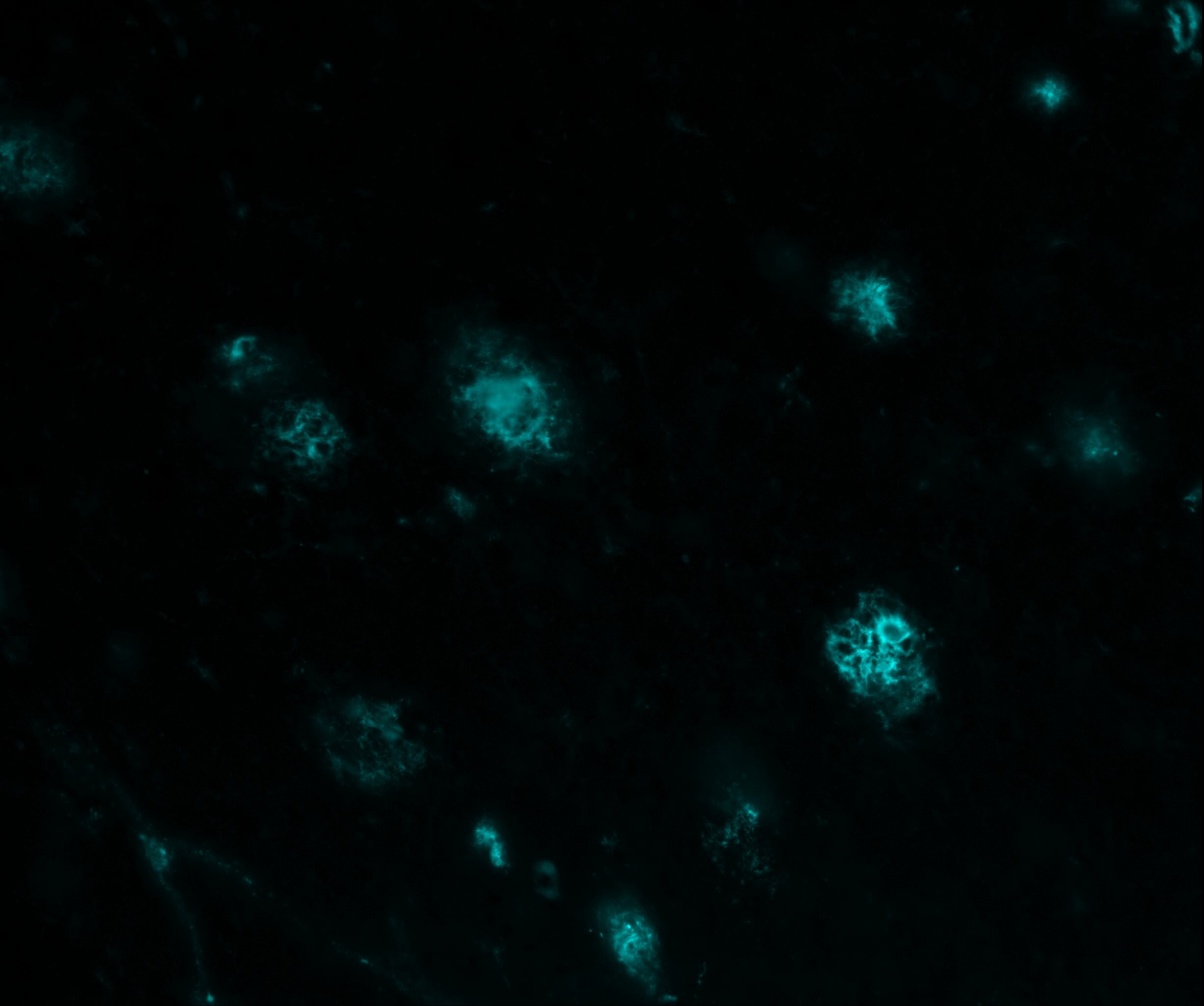 beta Amyloid Antibody (MOAB-2) - BSA Free NBP2-13075