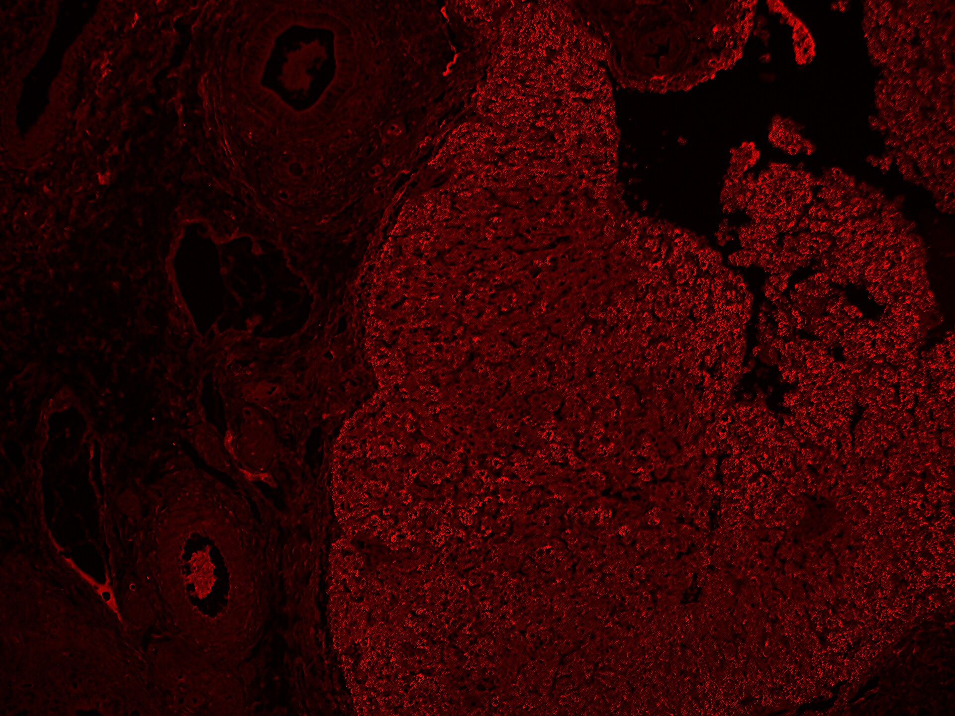 Hydroxyacid Oxidase-1/HAO-1 Antibody - BSA Free NBP2-14080