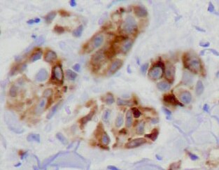 NCAM-1/CD56 Antibody (123C3.D5) NBP2-15184