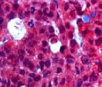 MUC5AC Antibody (45M1) NBP2-15196