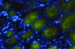 MUC5AC Antibody (45M1) NBP2-15196