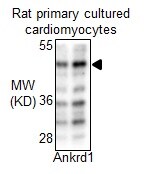ANKRD1 Antibody NBP2-15397