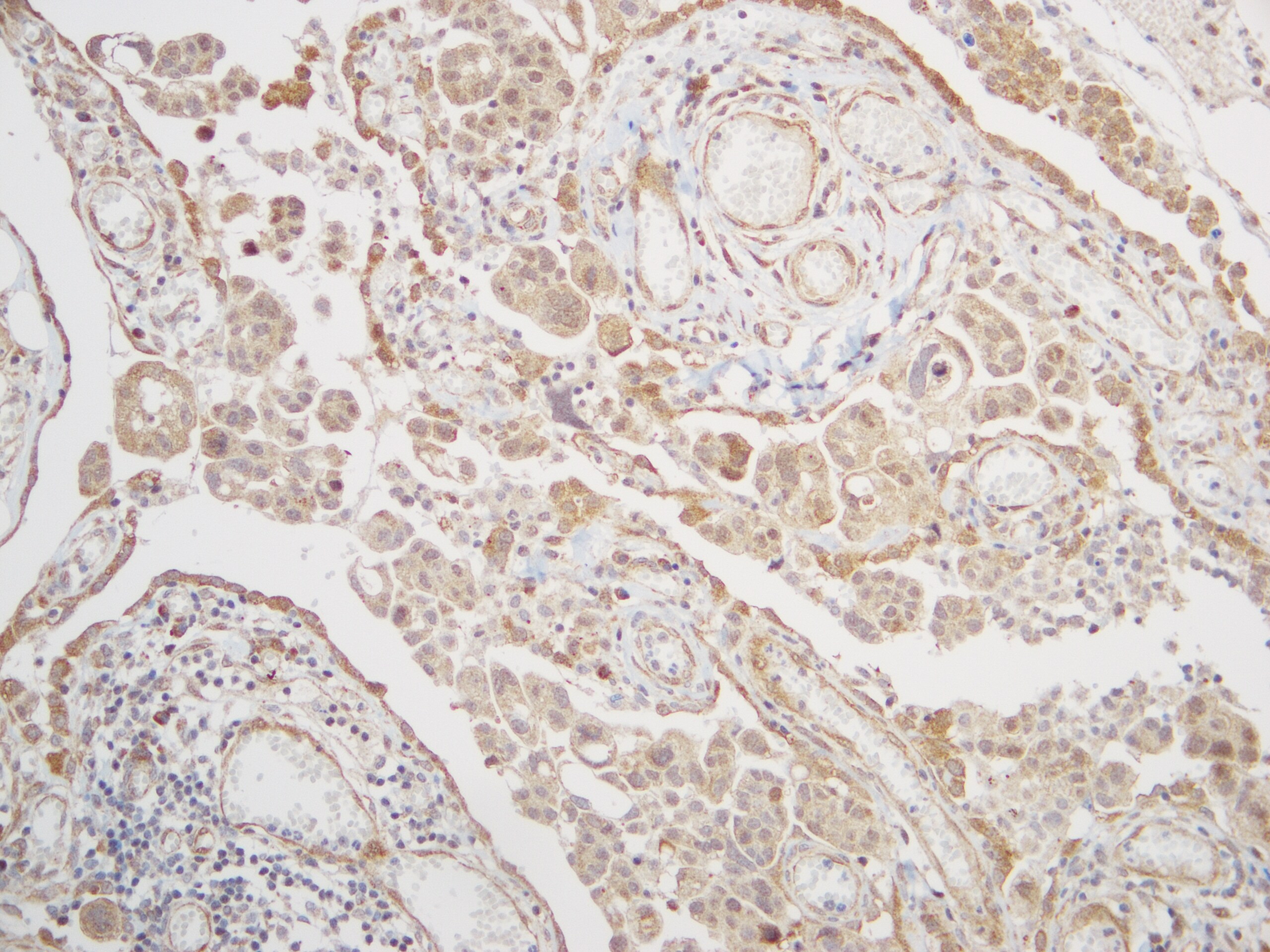 BAG3 Antibody - BSA Free NBP2-15543