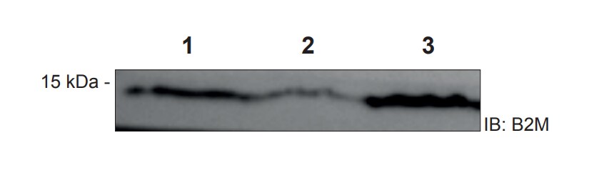 beta 2-Microglobulin Antibody NBP2-15566