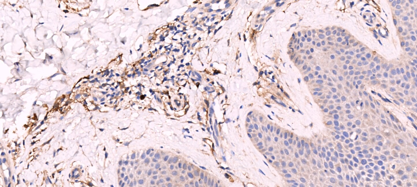 Neprilysin/CD10 Antibody - BSA Free NBP2-15771