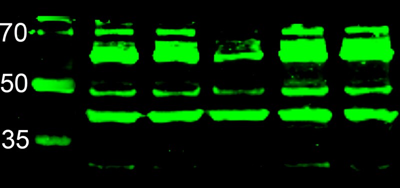 CTGF/CCN2 Antibody NBP2-16025