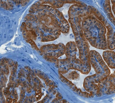 Cytokeratin 8 Antibody - BSA Free NBP2-16094