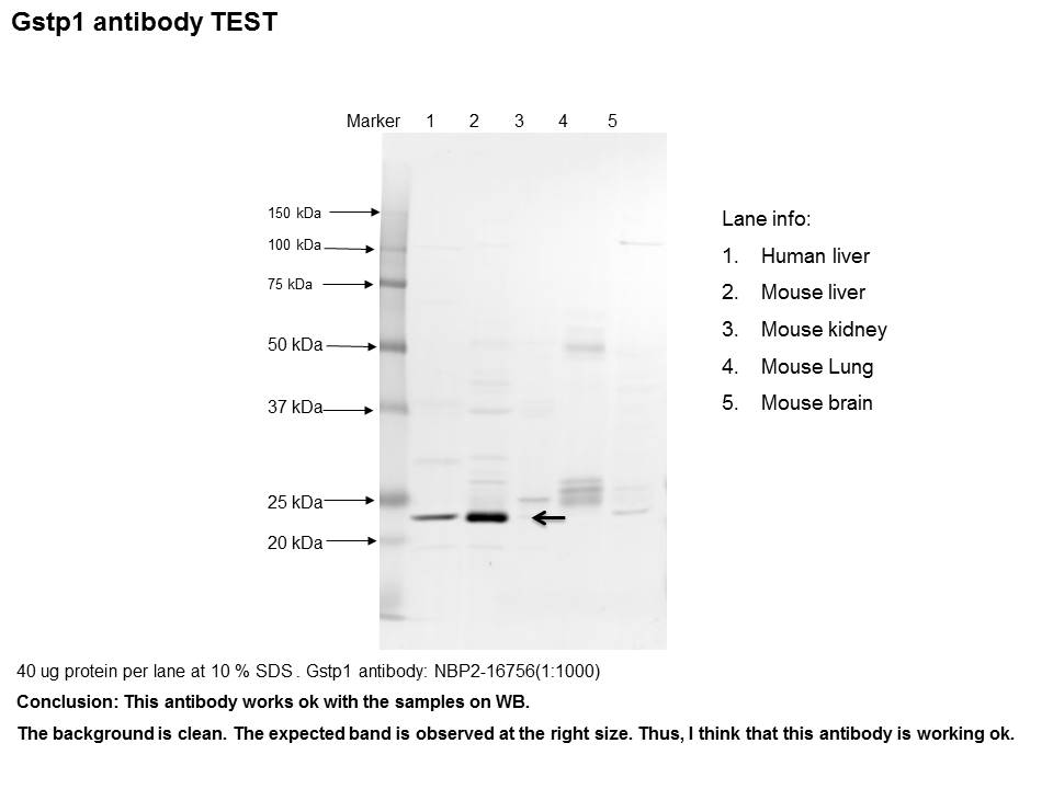 Glutathione S-Transferase pi 1/GSTP1 Antibody - BSA Free NBP2-16756