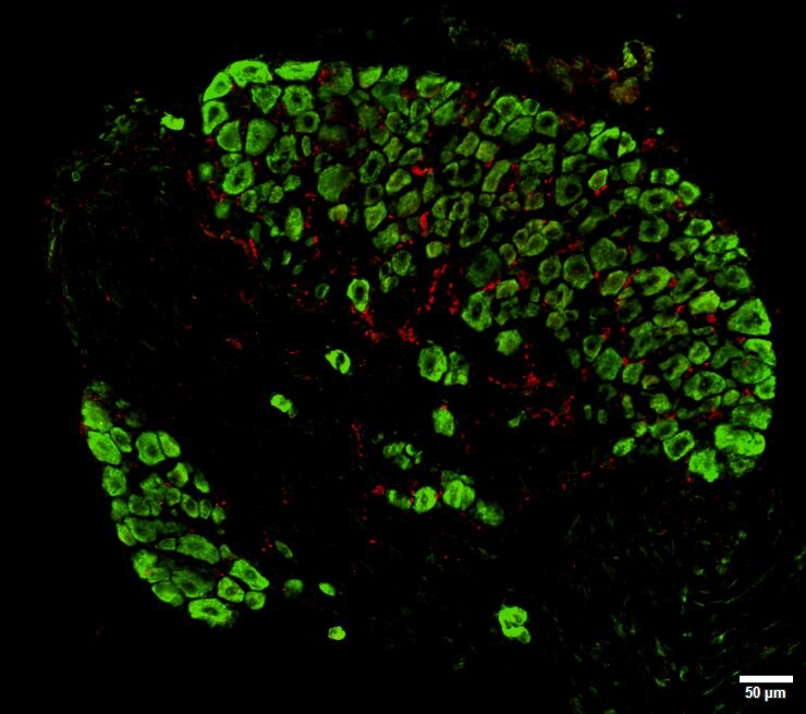 AIF-1/Iba1 Antibody - Azide and BSA Free NBP2-19019
