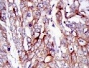 E-Cadherin Antibody (7H12) NBP2-19051