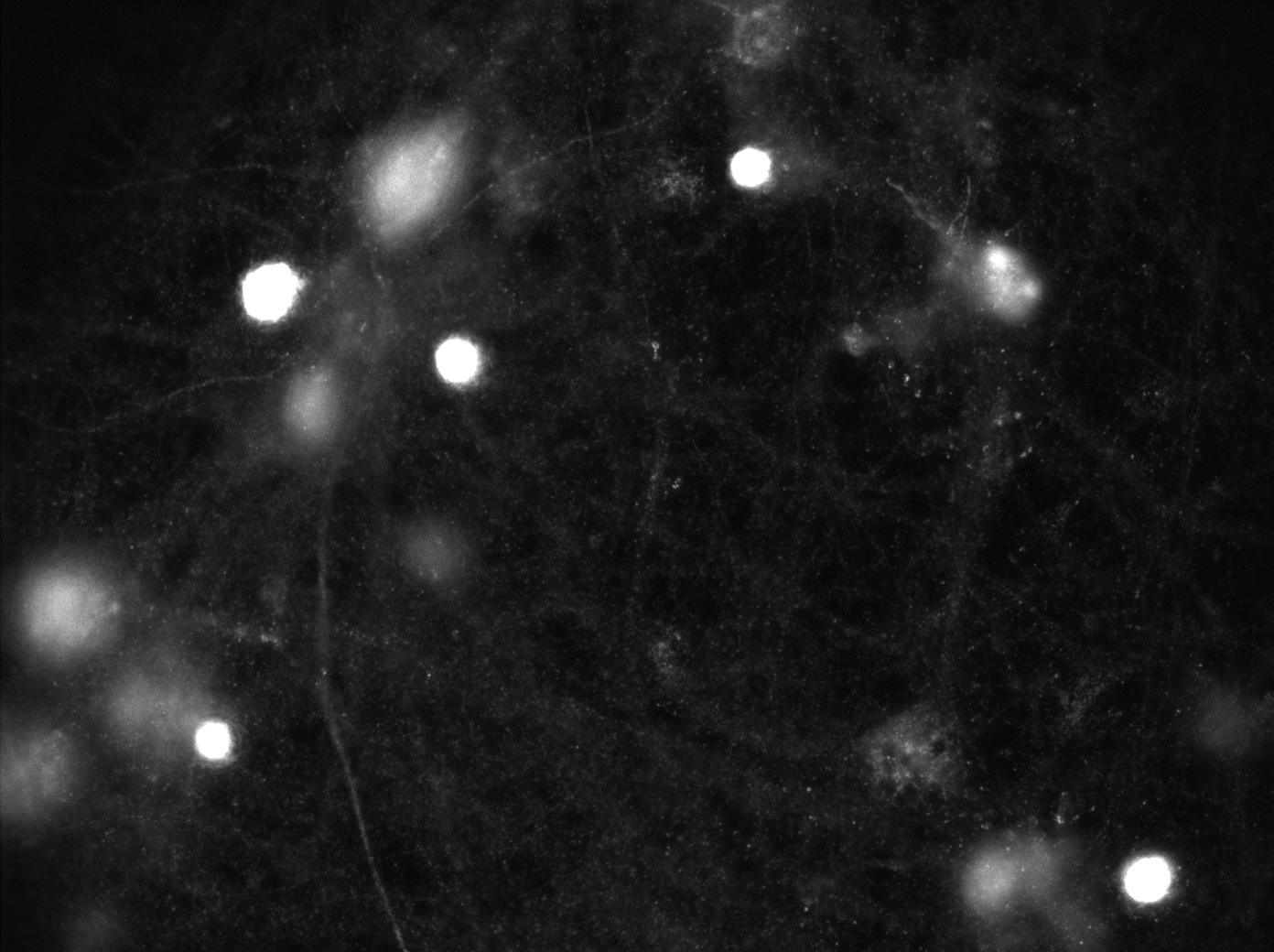 NMDAR2A Antibody - BSA Free NBP2-19551