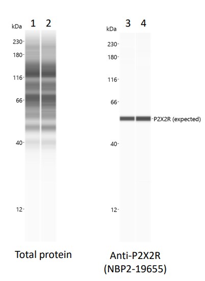 P2X2/P2RX2 Antibody - BSA Free NBP2-19655