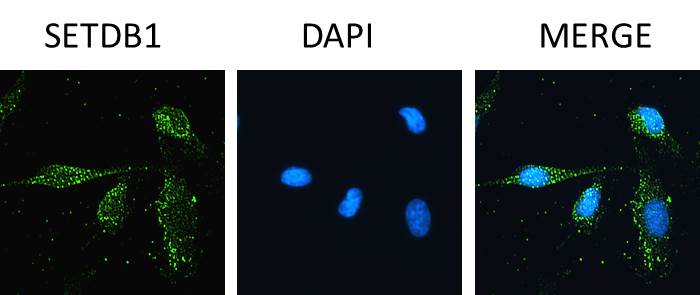SETDB1 Antibody - BSA Free NBP2-20322