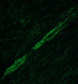 Transgelin/TAGLN/SM22 alpha Antibody - BSA Free NBP2-20405