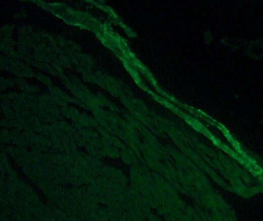 Transgelin/TAGLN/SM22 alpha Antibody - BSA Free NBP2-20405