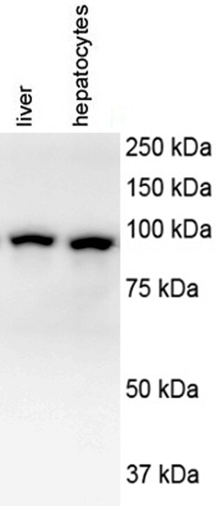 USP6NL Antibody NBP2-20839