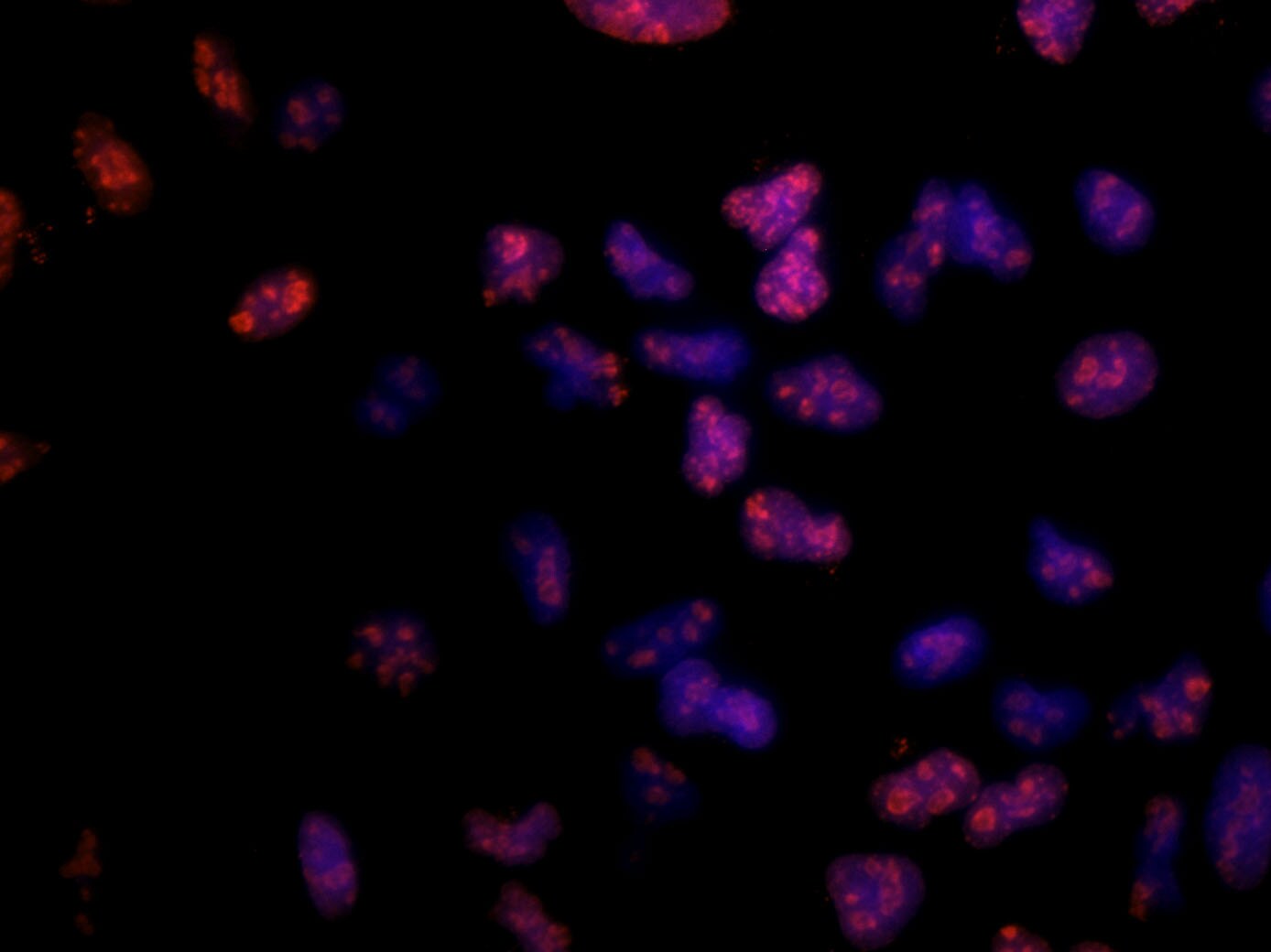 Ki67/MKI67 Antibody (8D5) - BSA Free NBP2-22112