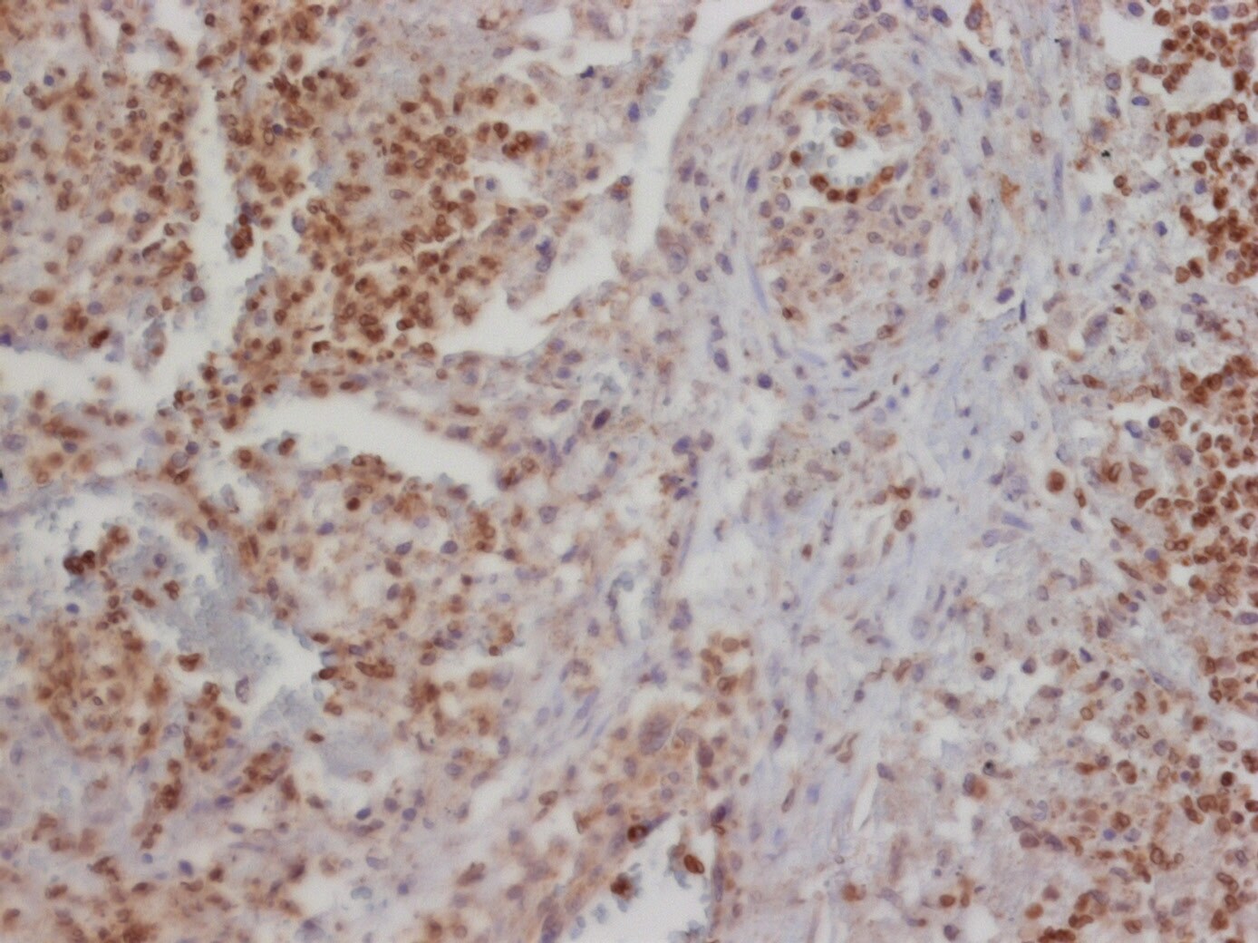 CCL2/MCP1 Antibody (2D8) - BSA Free NBP2-22115
