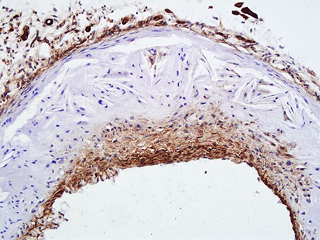 alpha-Smooth Muscle Actin Antibody (4A4) NBP2-22120
