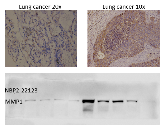 MMP-1 Antibody (6A5) - BSA Free NBP2-22123