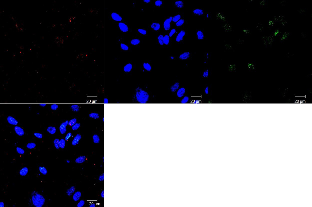 ABCG2/CD338 Antibody (3G8) - BSA Free NBP2-22124
