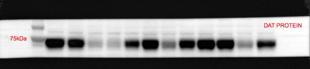 SLC6A3/DAT1 Antibody (mAb16) - BSA Free NBP2-22164