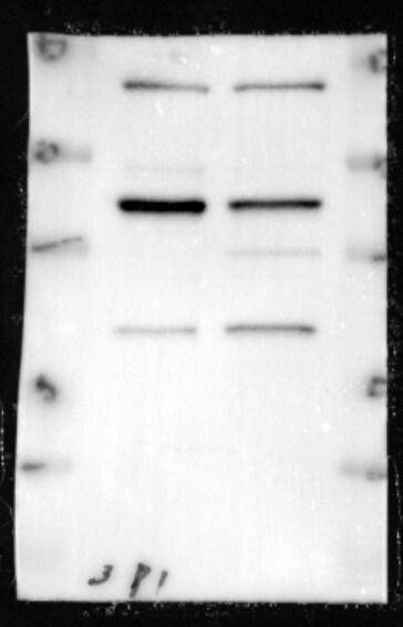 Pyruvate Dehydrogenase Kinase 1/PDK1 Antibody (4A11) NBP2-22171