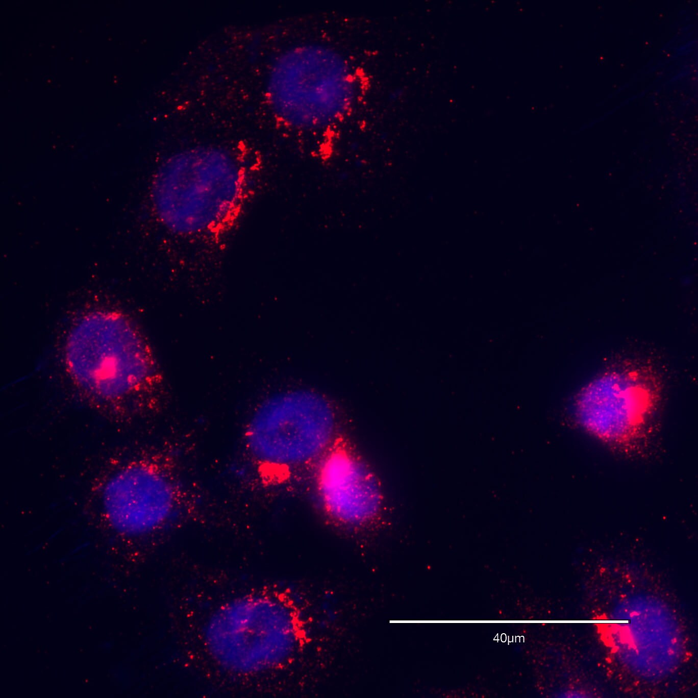 GOLGB1/Giantin Antibody - BSA Free NBP2-22321