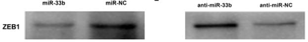 ZEB1 Antibody (2A8A6) - BSA Free NBP2-23484