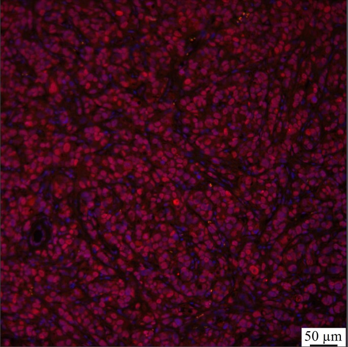 GLI-2 Antibody - BSA Free NBP2-23602