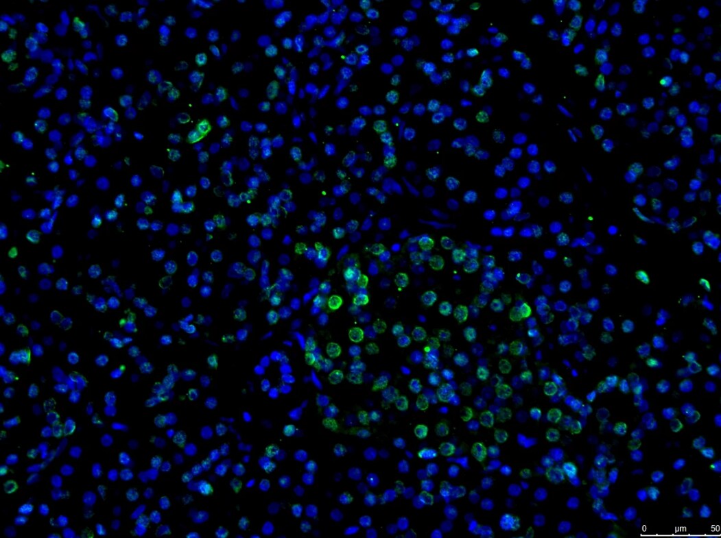 GATA-4 Antibody - BSA Free NBP2-24585