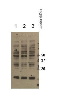 MEIS1 Antibody NBP2-24597