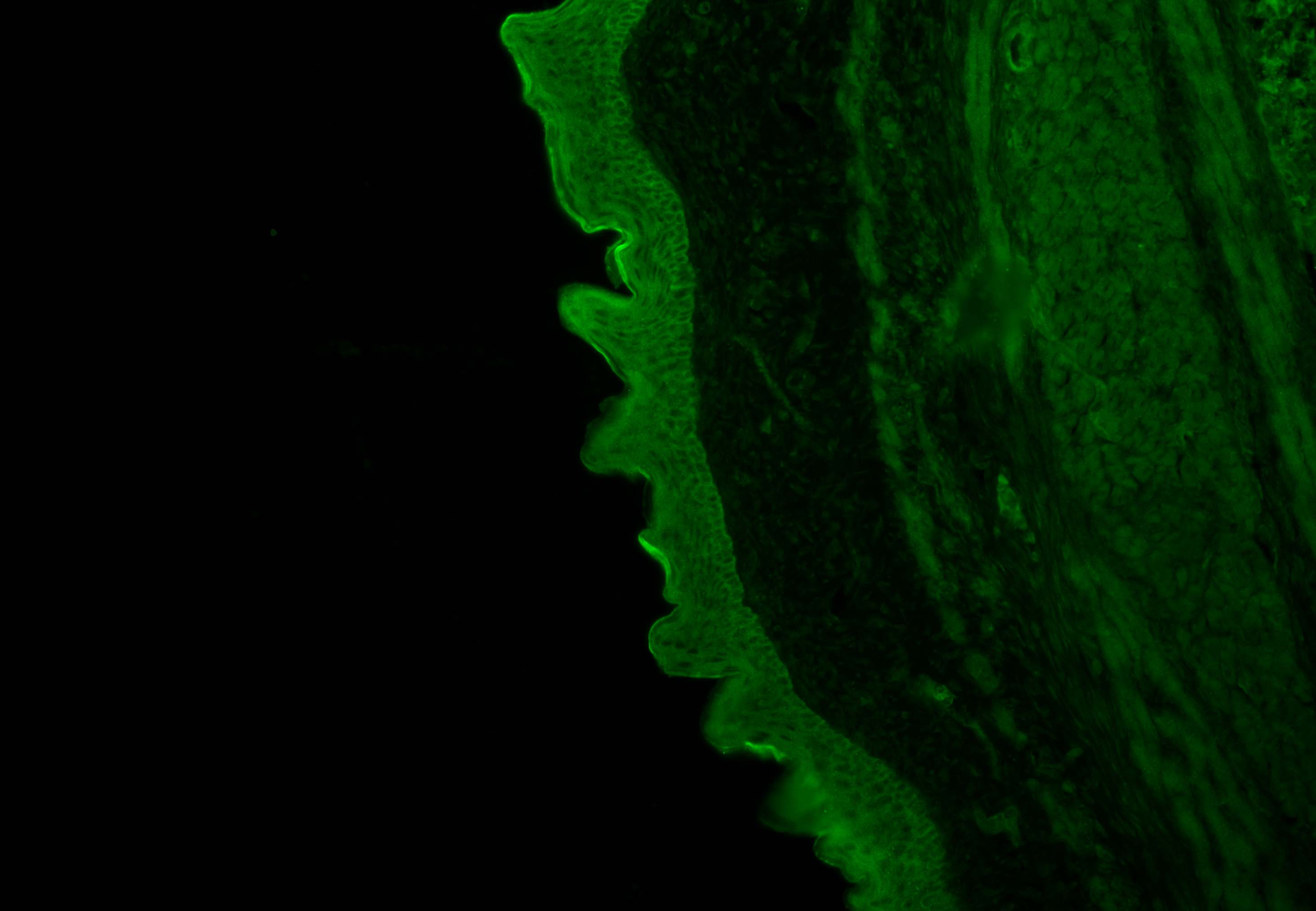 Wnt-5a Antibody - BSA Free NBP2-24752