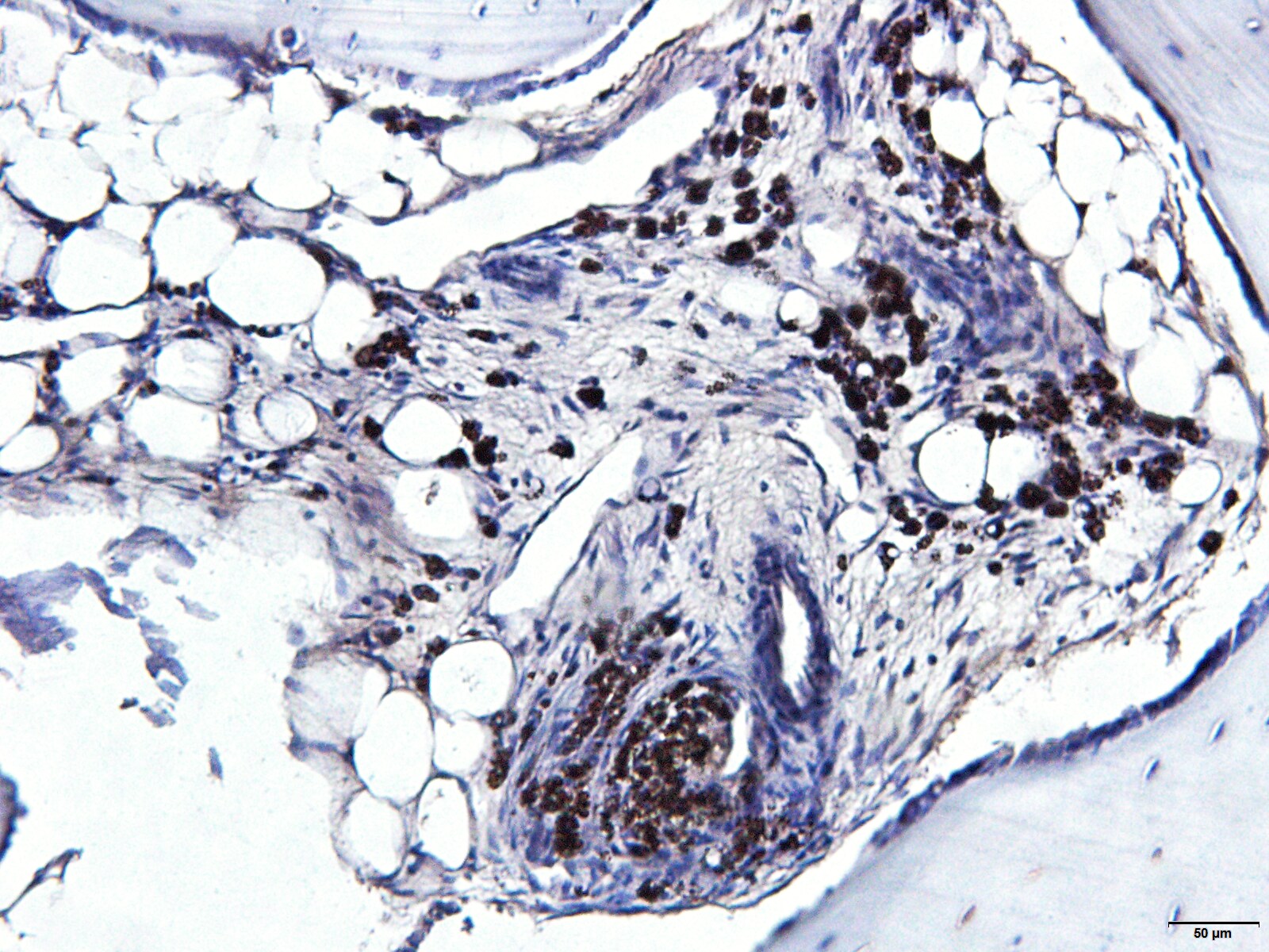 RUNX2/CBFA1 Antibody - BSA Free NBP2-24755