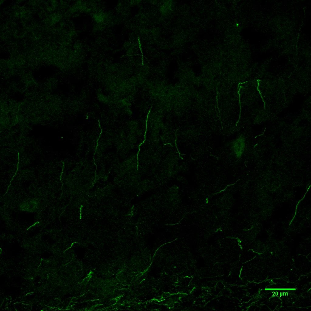 TLR7 Antibody - BSA Free NBP2-24906