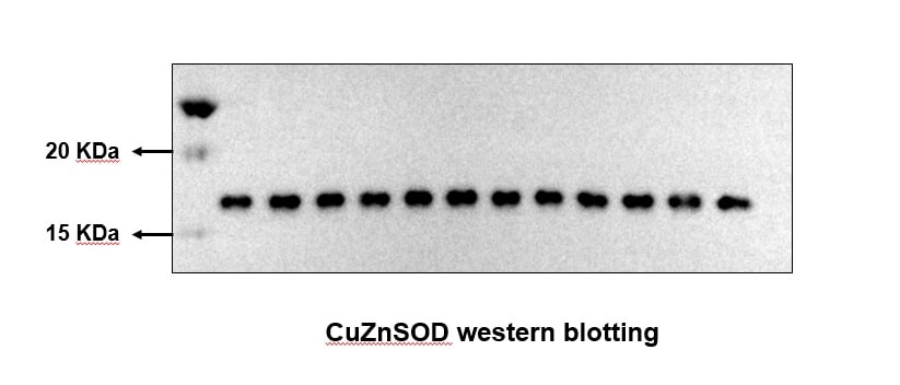 SOD1/Cu-Zn SOD Antibody - BSA Free NBP2-24915