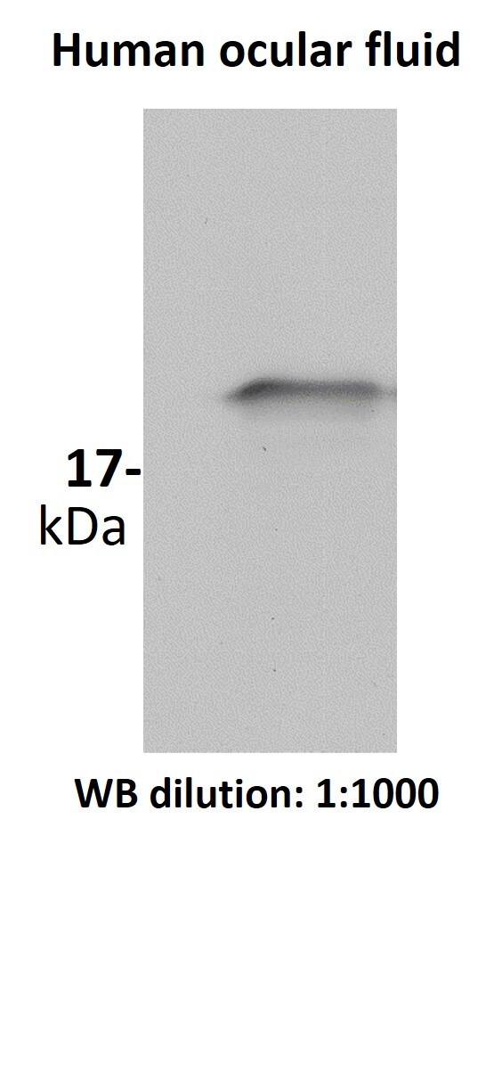 SOD1/Cu-Zn SOD Antibody - BSA Free NBP2-24915