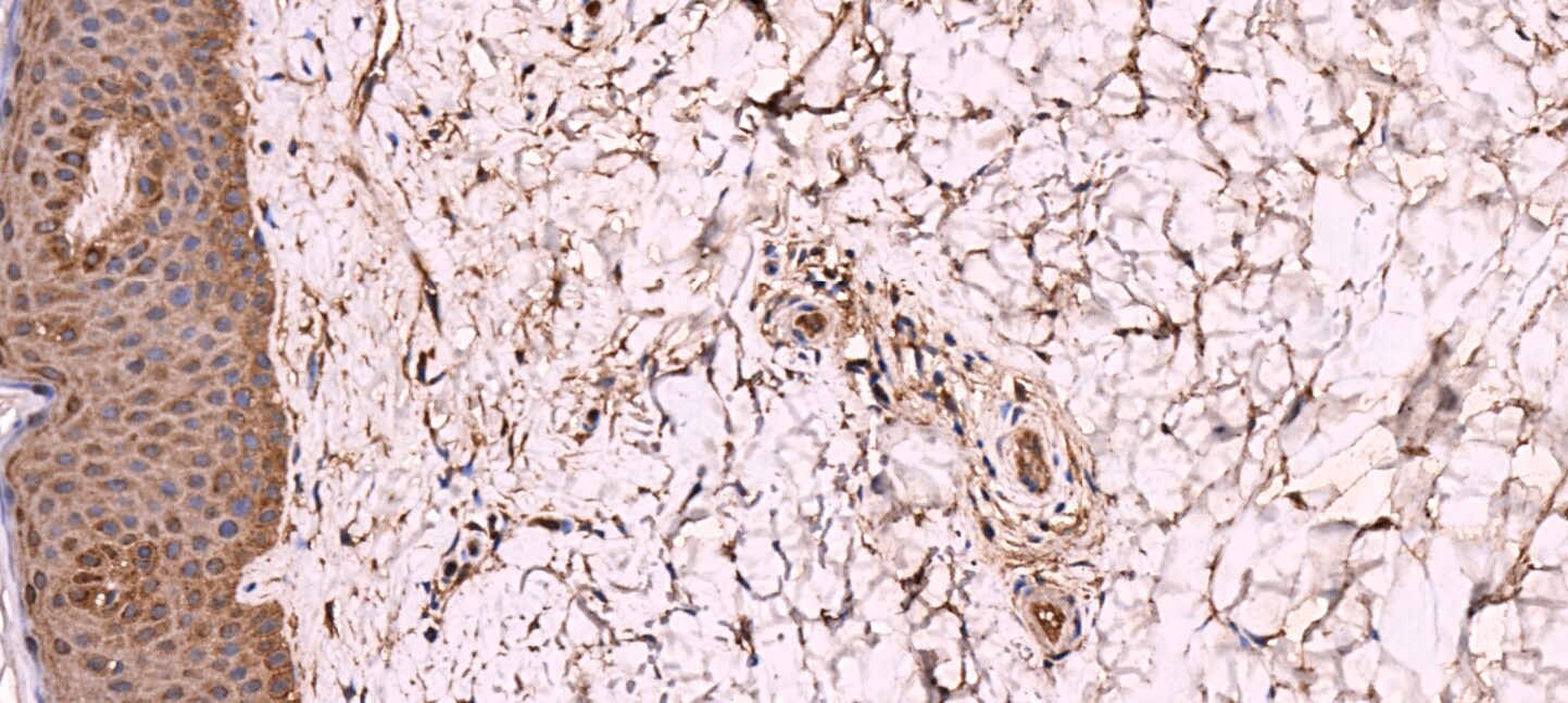beta Amyloid Antibody - BSA Free NBP2-25093