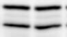 Lamin A + C Antibody NBP2-25153