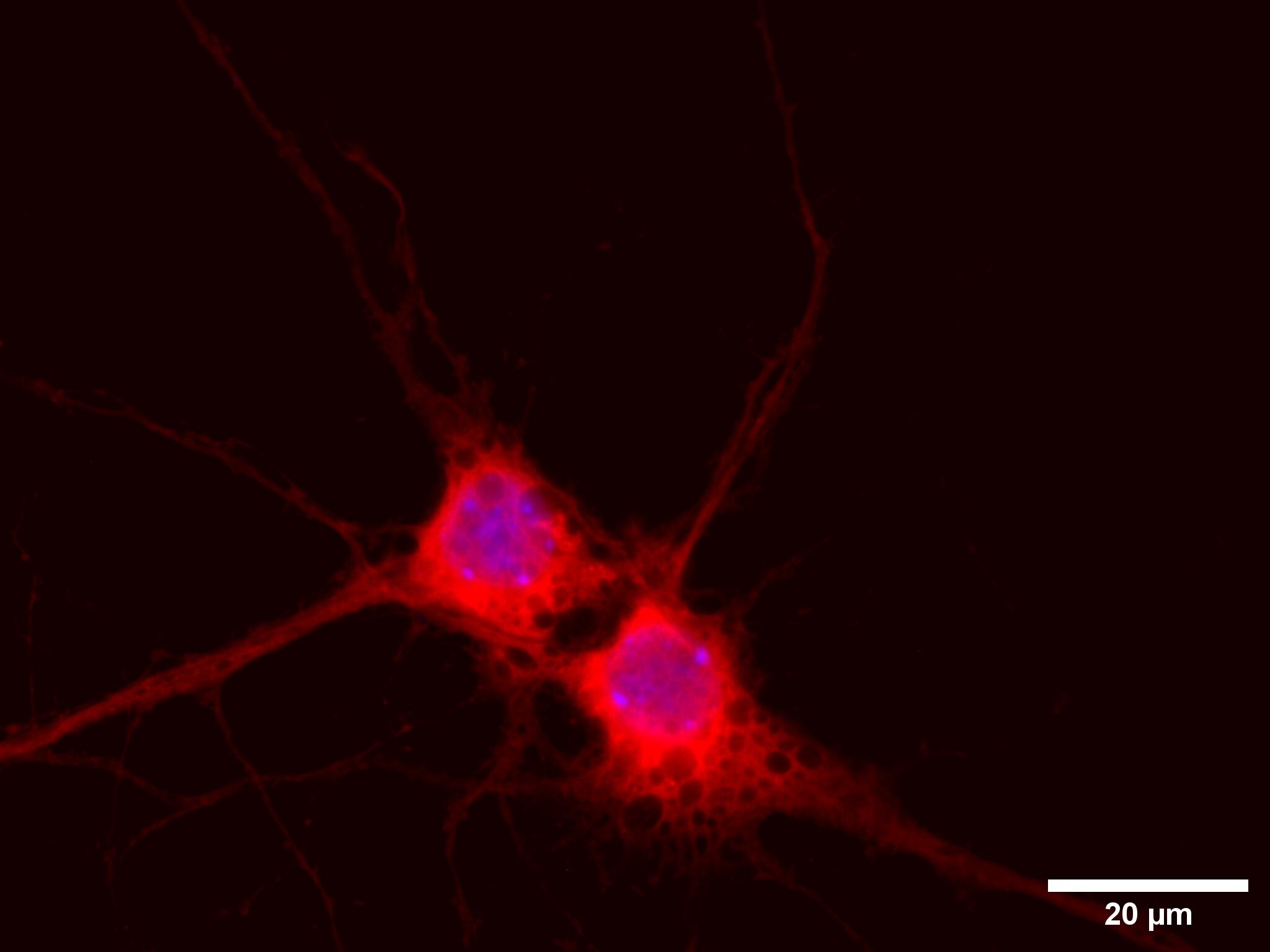 mCherry Antibody - BSA Free NBP2-25158