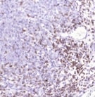 CD2 Antibody (RPA-2.10) - BSA Free NBP2-25200