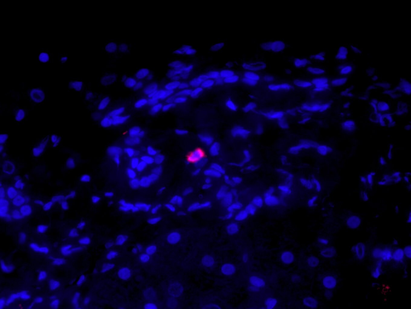 Tryptase alpha/beta 1 Antibody (AA1) NBP2-26444