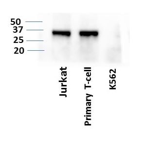 LIF Antibody (39N7D10) - BSA Free NBP2-27406