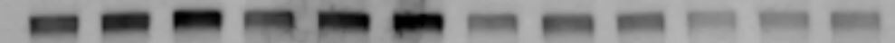 SynGAP Antibody NBP2-27541