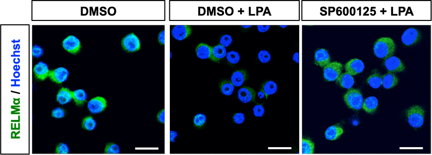 FIZZ1/RELM alpha Antibody - BSA Free NBP2-29355
