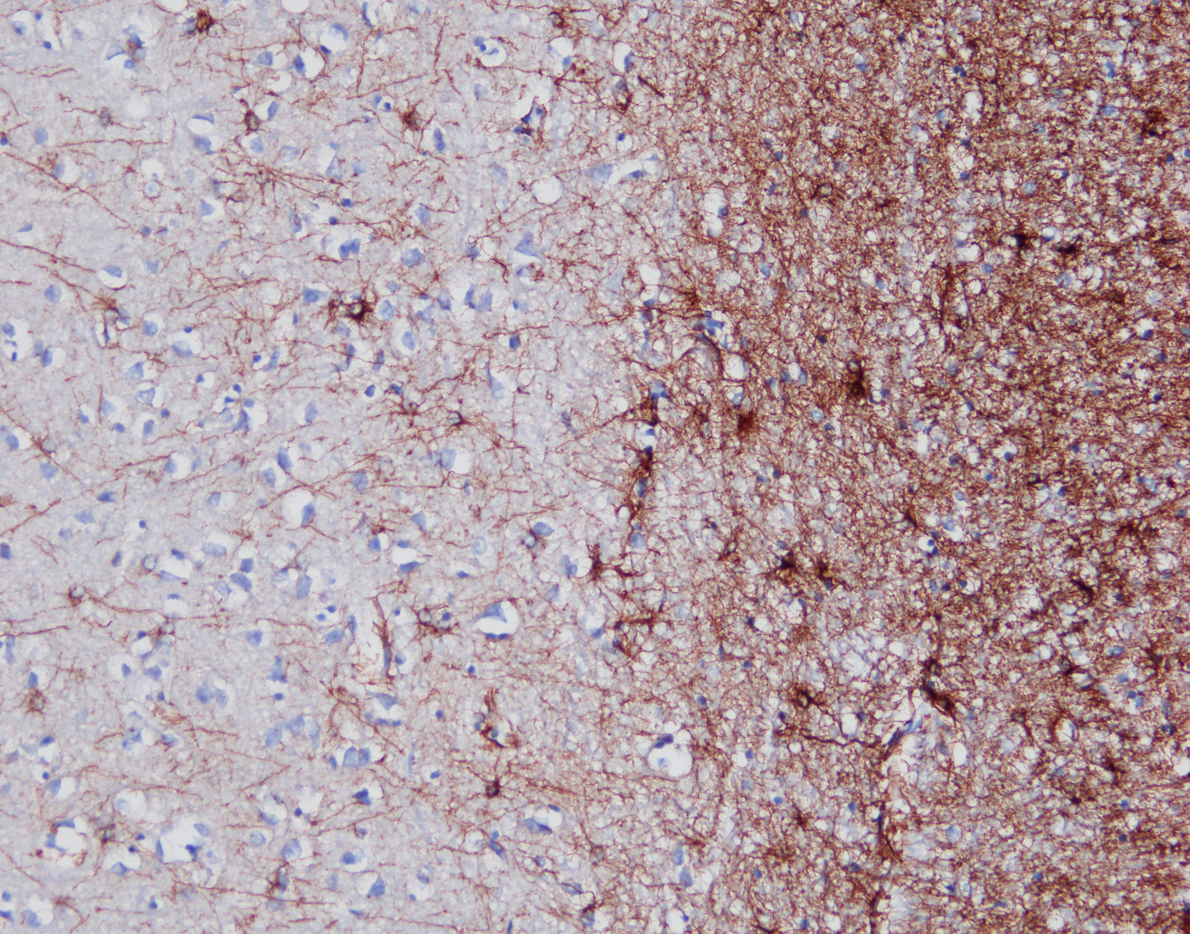 GFAP Antibody (GA-5) NBP2-29415