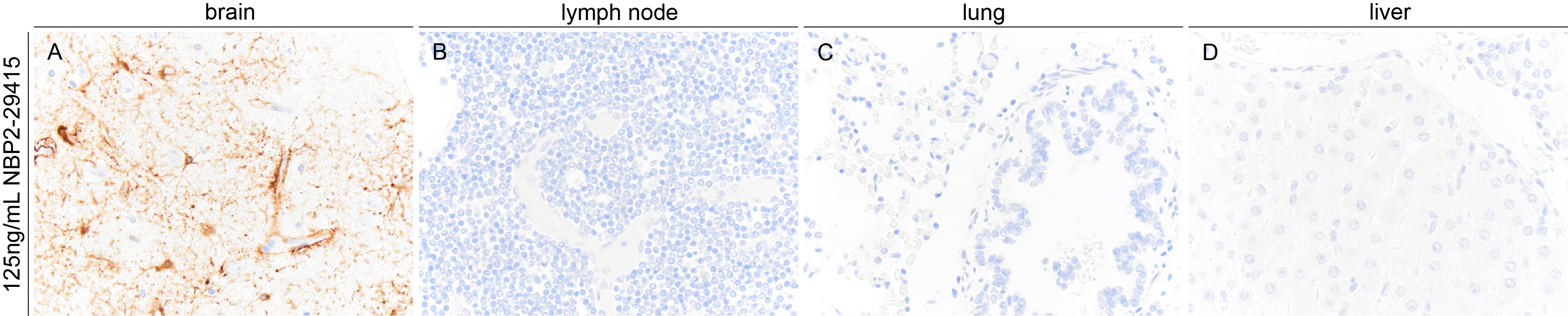 GFAP Antibody (GA-5) NBP2-29415