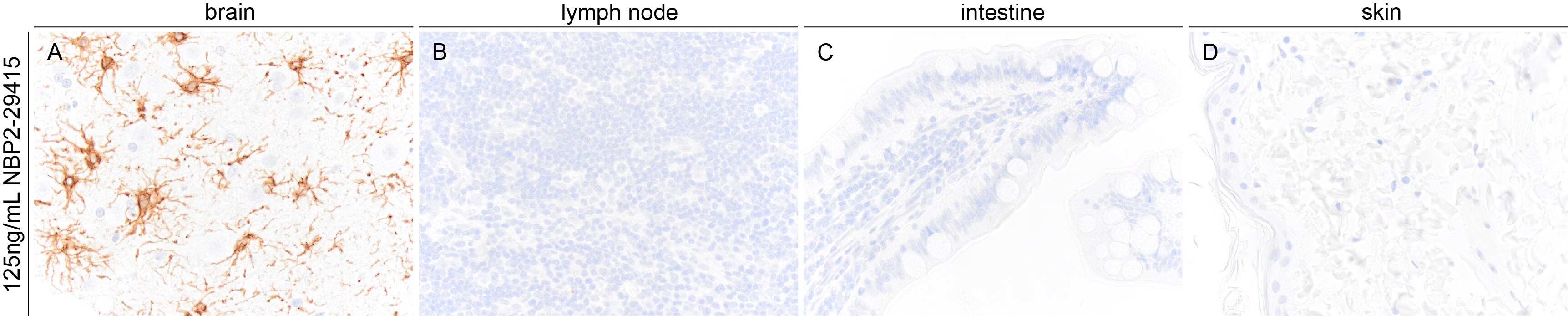GFAP Antibody (GA-5) NBP2-29415