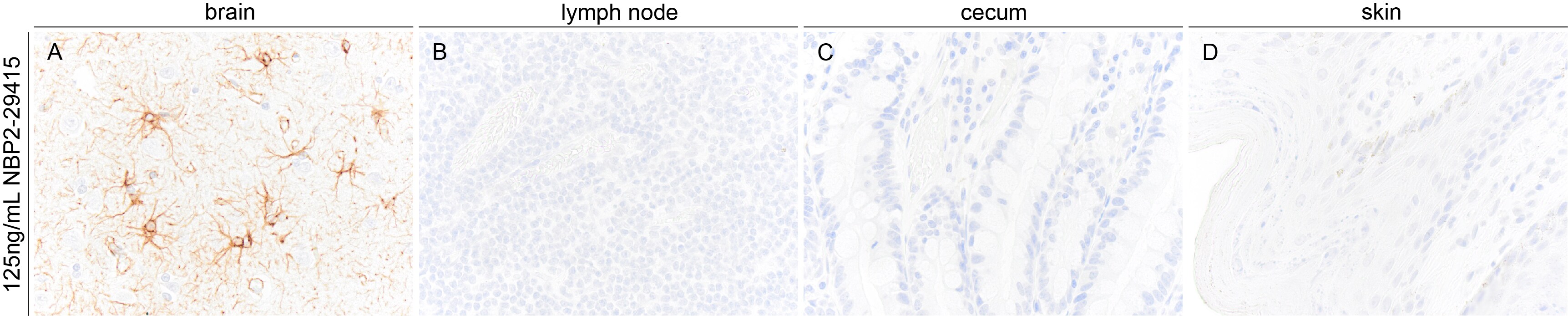 GFAP Antibody (GA-5) NBP2-29415